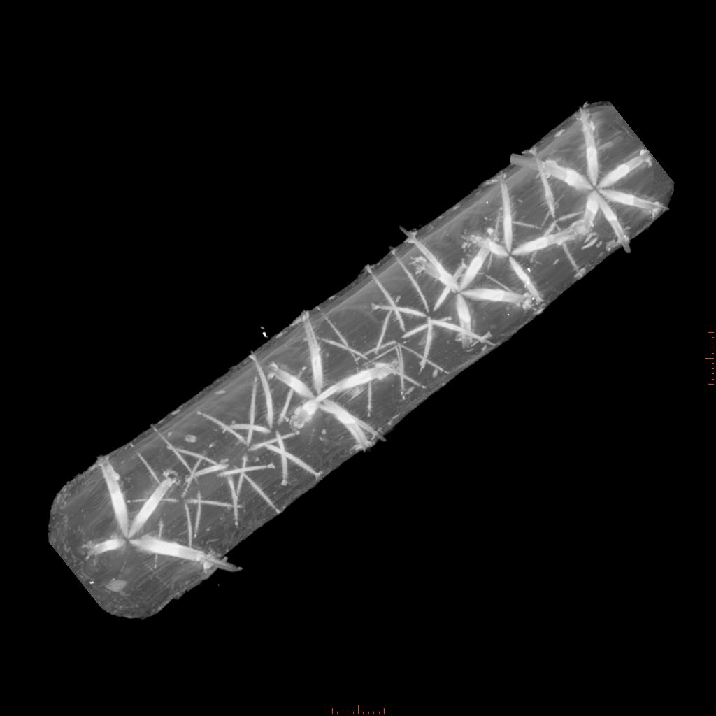 Scanner à rayons X billon